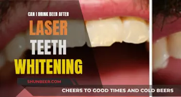 Laser Teeth Whitening: Beer Drinking Post-Procedure