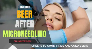 Microneedling: Drinking Beer, What You Need to Know