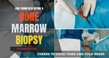 Beer and Bone Biopsy: Is It Safe to Drink?