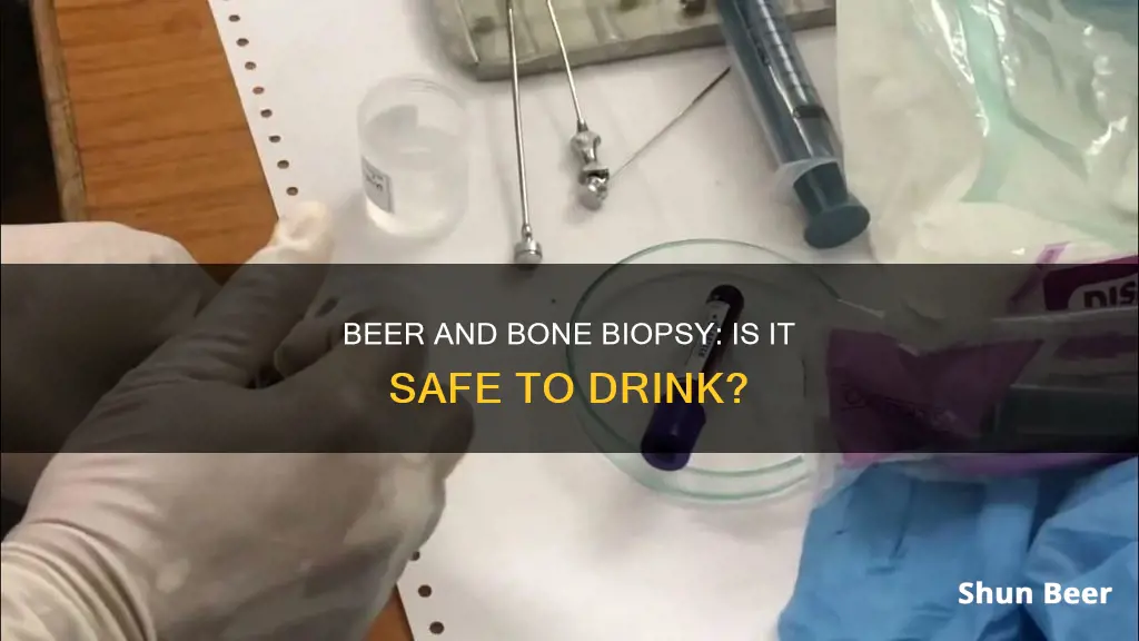 can I drink beer before a bone marrow biopsy