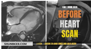 Beer and Heart Scans: What You Need to Know