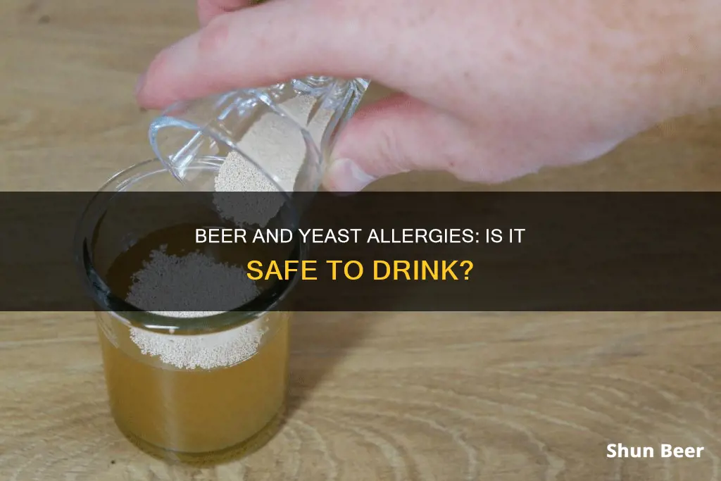 can I drink beer if I am allergic to yeast