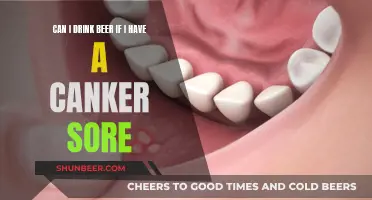 Beer and Canker Sores: Is It Safe to Drink?