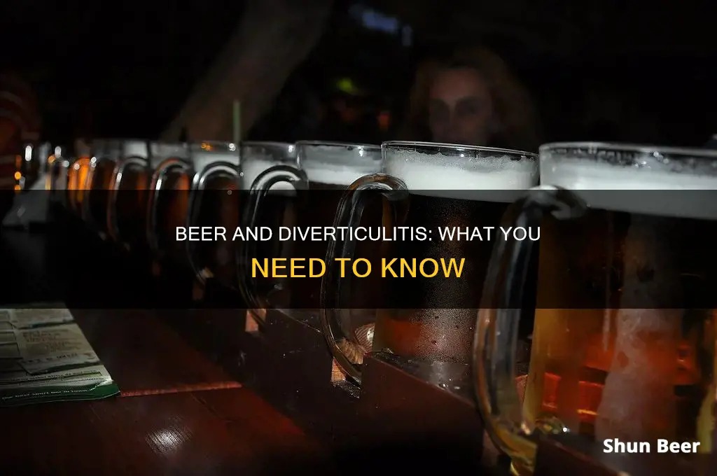 can I drink beer if I have diverticulitis