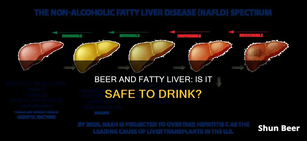 can I drink beer if I have fatty liver