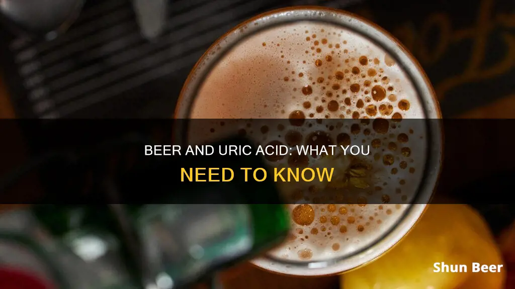 can I drink beer if I have high uric acid