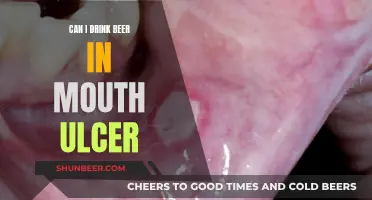 Beer and Mouth Ulcers: Is It Safe to Drink?