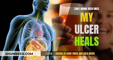 Healing Ulcers: Can Beer Be Consumed Post-Recovery?