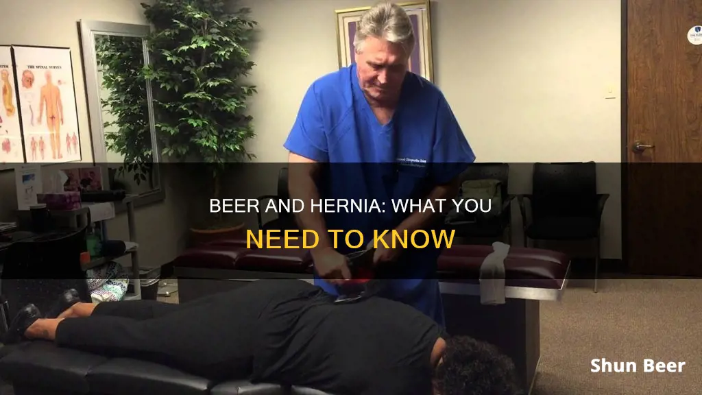 can I drink beer with a hernia