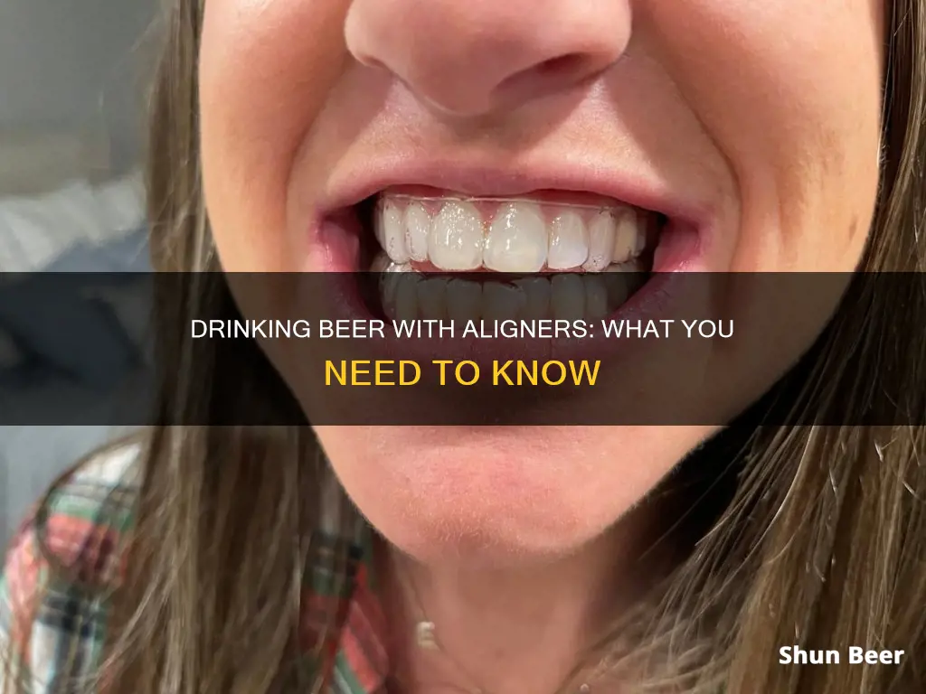 can I drink beer with aligners