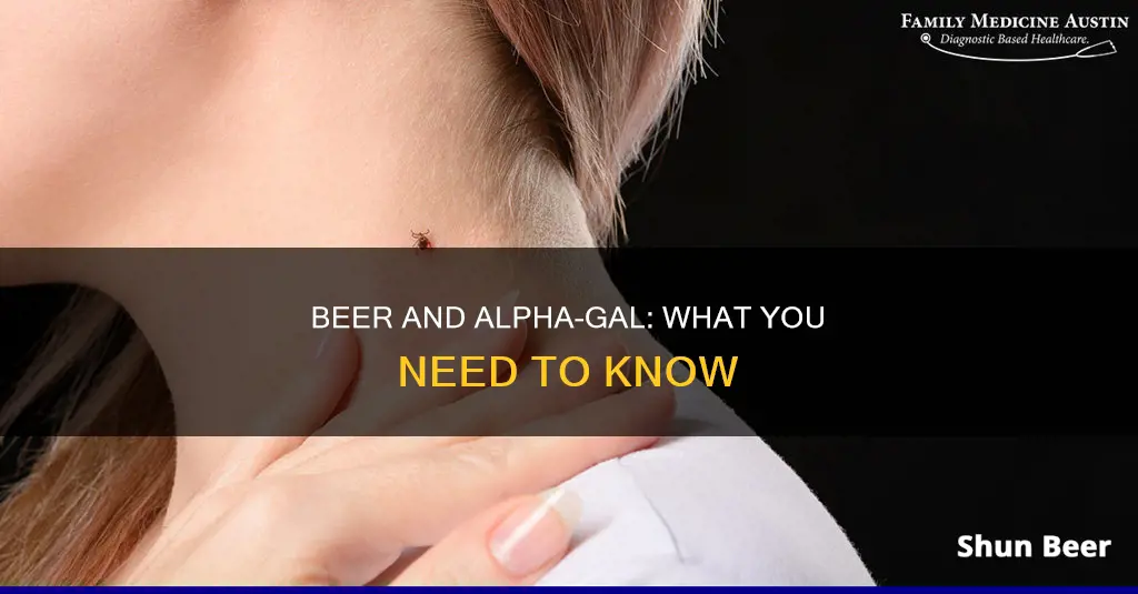 can I drink beer with alpha-gal