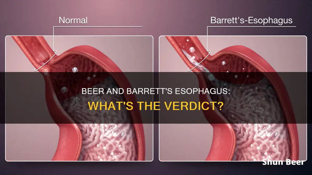 can I drink beer with barrett