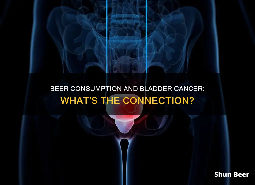 can I drink beer with bladder cancer