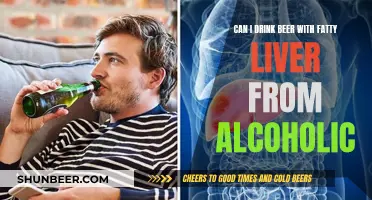 Beer and Fatty Liver: A Dangerous Combination