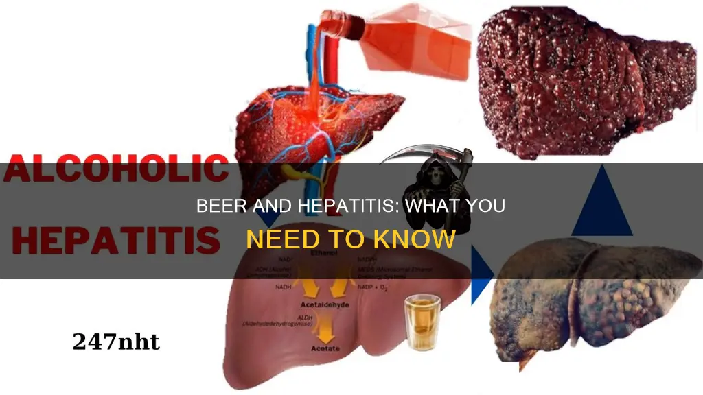 can I drink beer with hepatitis