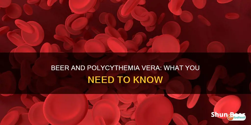 can I drink beer with polycythemia vera