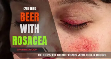 Beer and Rosacea: What's the Connection?