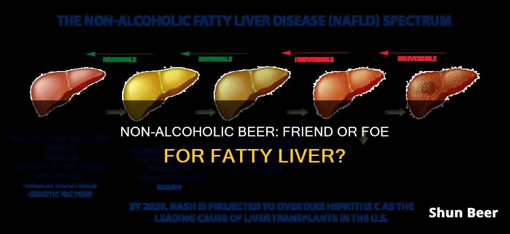 can I drink non alcoholic beer with a fatty liver