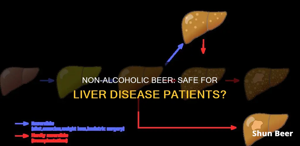 can I drink non alcoholic beer with liver disease