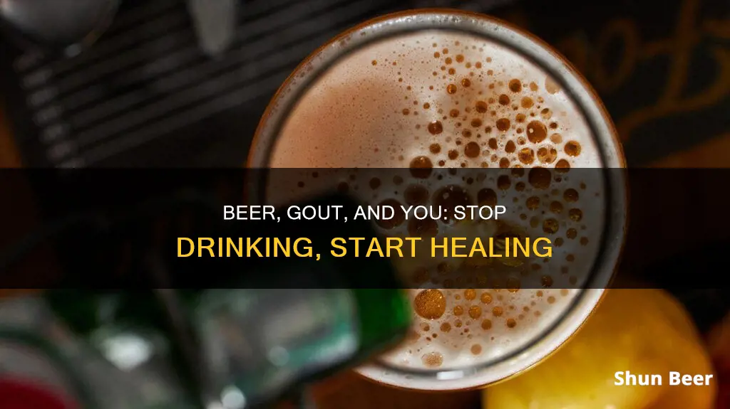 can stopping beer drinking eliminate gout