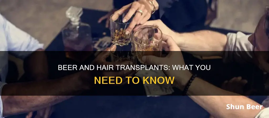 can we drink beer after hair transplant