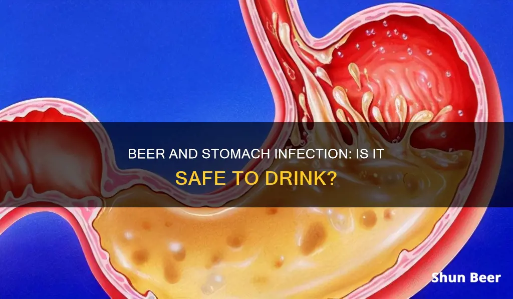 can we drink beer in stomach infection