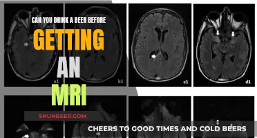 Beer and MRI: What You Need to Know