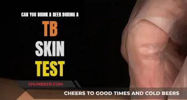 Beer and TB Skin Test: Safe or Not?