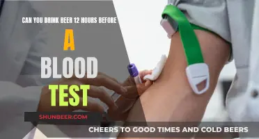 Will Beer Affect Your Blood Test?