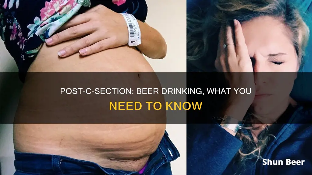 can you drink beer after a c section