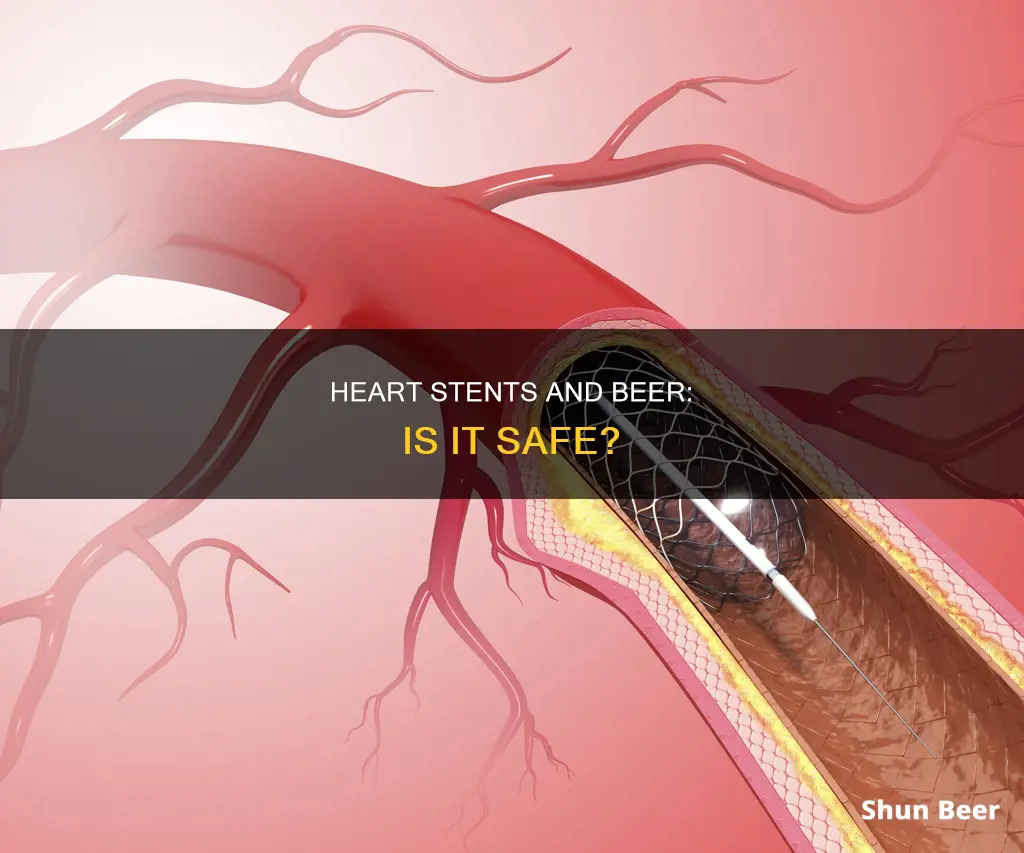 can you drink beer after a heart stent