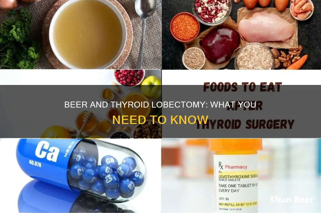 can you drink beer after a thyroid lobectomy