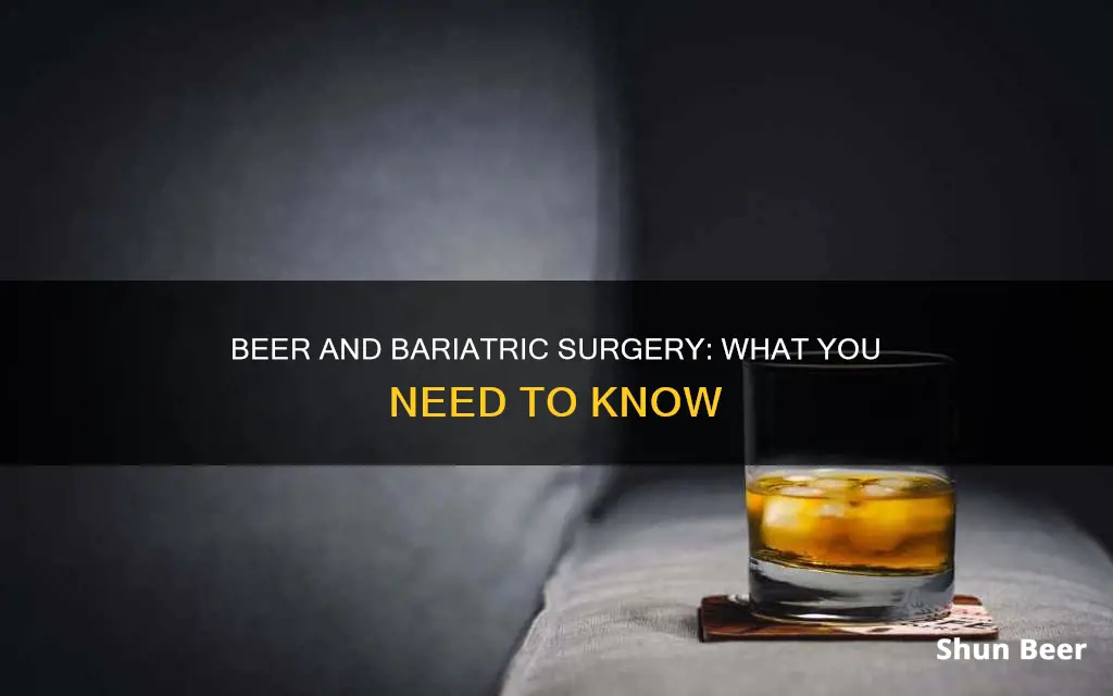 can you drink beer after bariatric sleeve surgery