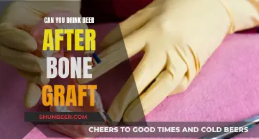 Beer and Bone Grafts: What You Need to Know