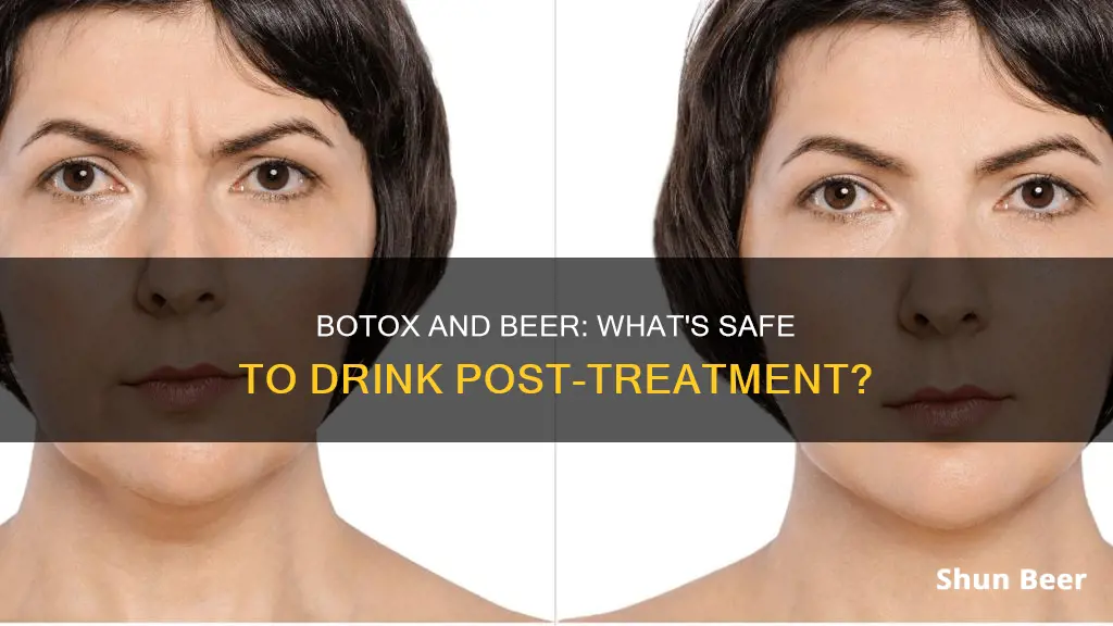 can you drink beer after botox