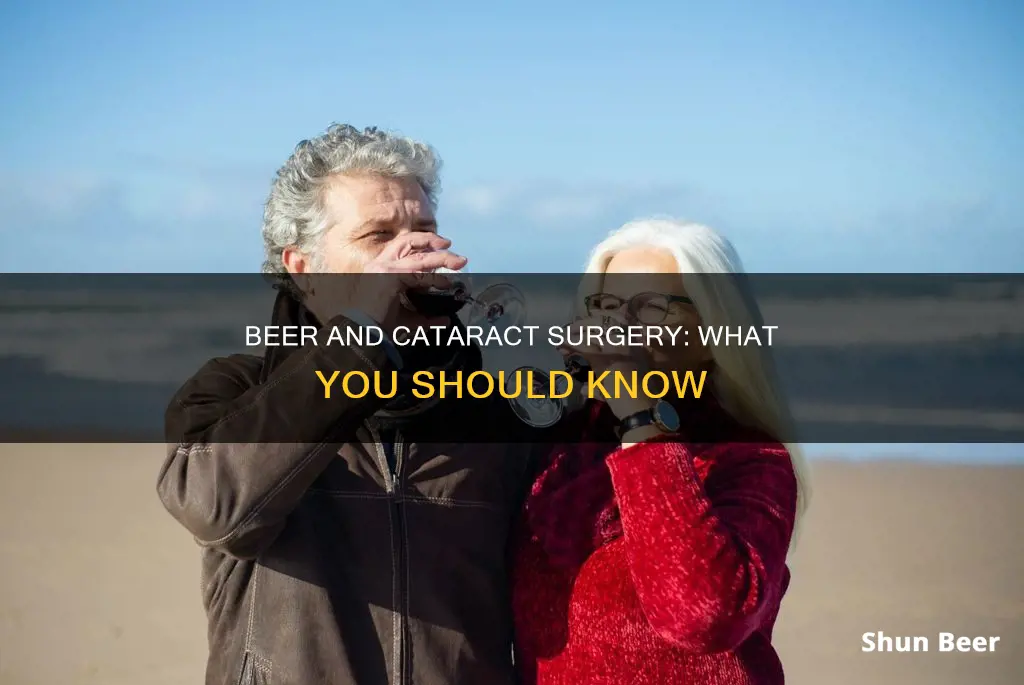 can you drink beer after cataract surgery