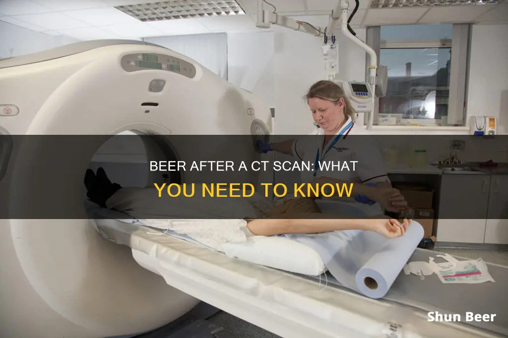 can you drink beer after ct scan with contrast