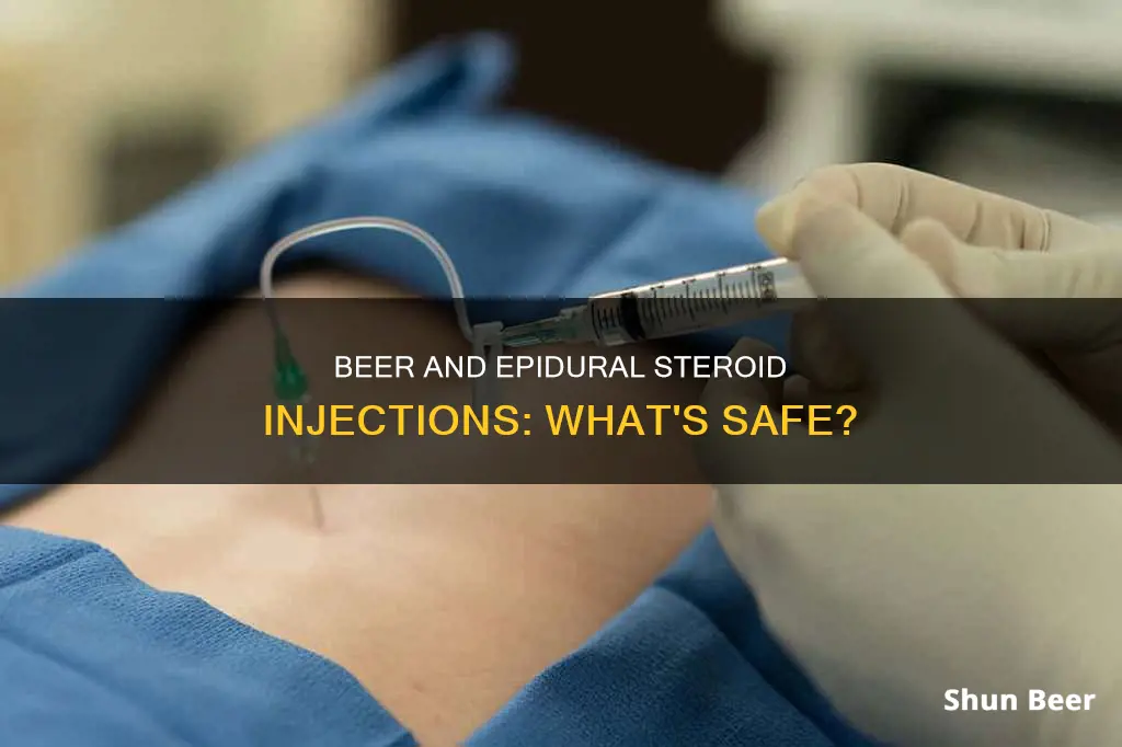 can you drink beer after epidural steroid injection