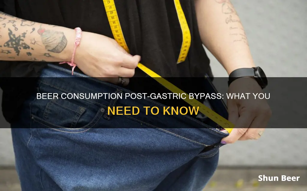 can you drink beer after gastric bypass