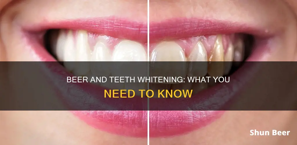 can you drink beer after getting teeth whitened