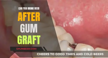 Beer and Gum Grafts: What You Need to Know