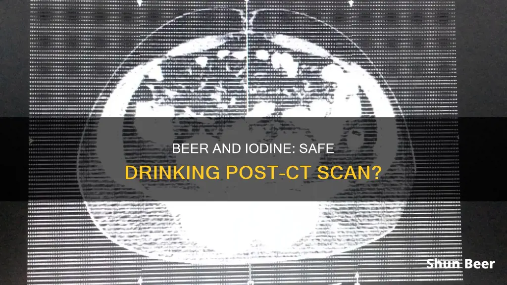 can you drink beer after iodine ct scan