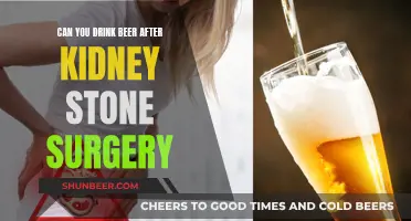 Beer and Kidney Stones: Post-Surgery Drinking Explored