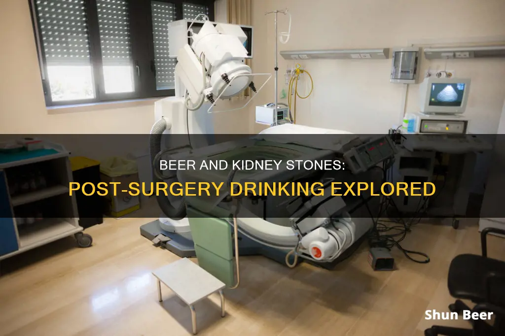 can you drink beer after kidney stone surgery