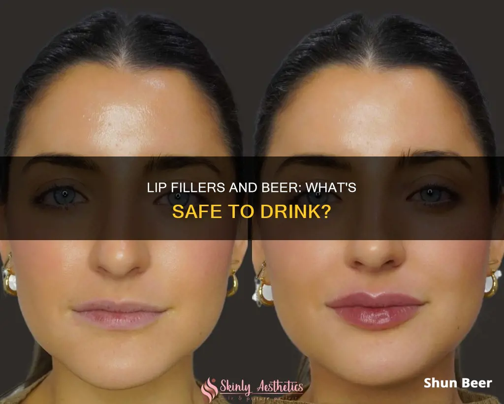 can you drink beer after lip fillers