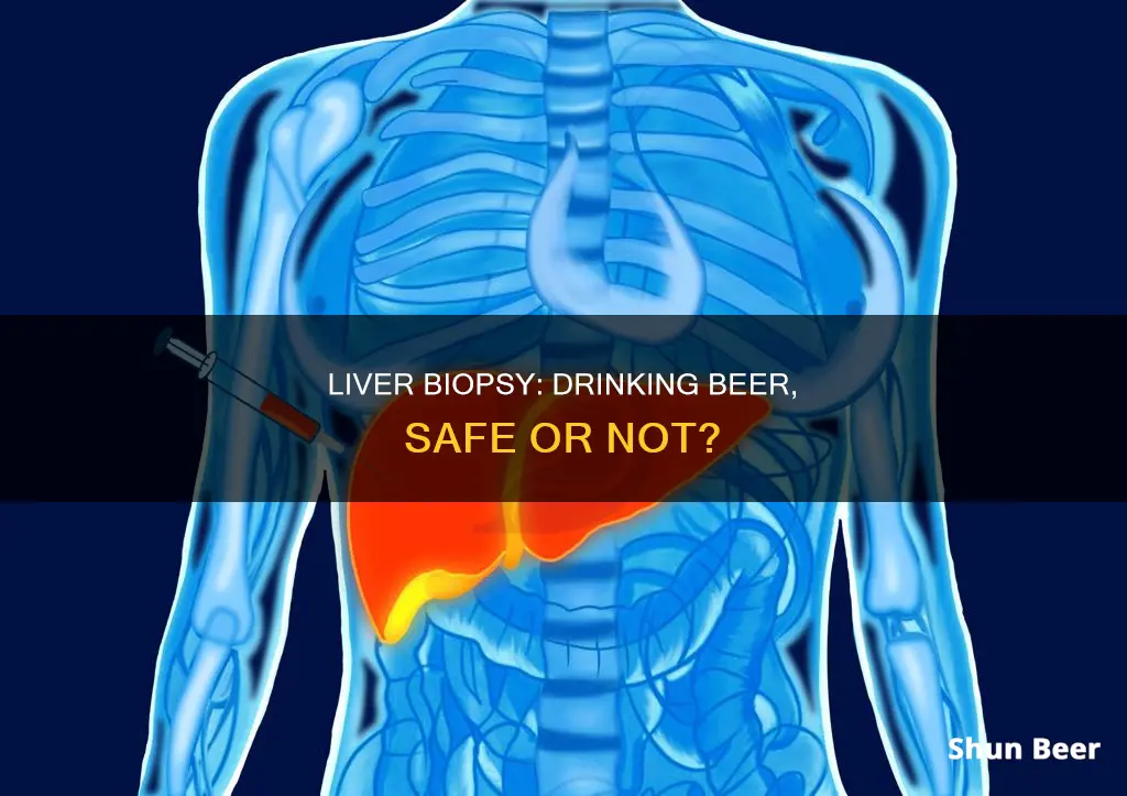 can you drink beer after liver biopsy