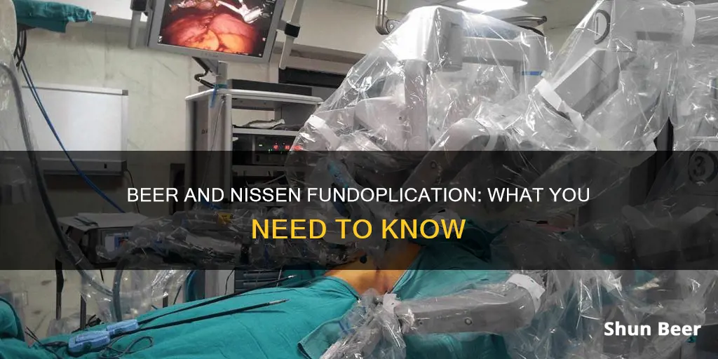 can you drink beer after nissen fundoplication