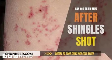 Shingles Shot: Beer Drinking and Safety Concerns