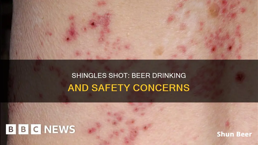 can you drink beer after shingles shot