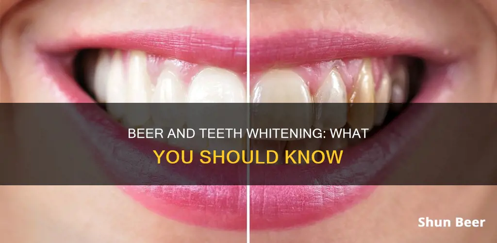 can you drink beer after teeth whitening